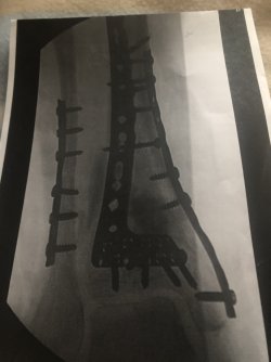 01959723-211B-4B46-BE41-DED568FCF003.jpeg