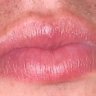 nilspils